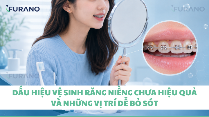 Dấu hiệu vệ sinh răng niềng chưa hiệu quả, Những vị trí dễ bỏ sót khi vệ sinh mắc cài