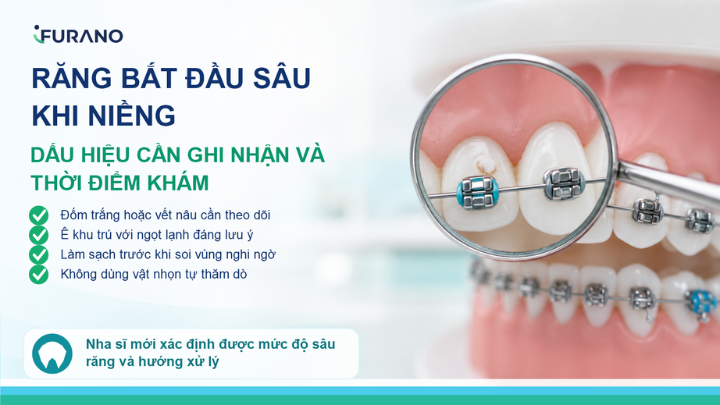 Sâu Răng Sớm Khi Niềng Có Thể Nhìn Thấy Bằng Mắt Không?
